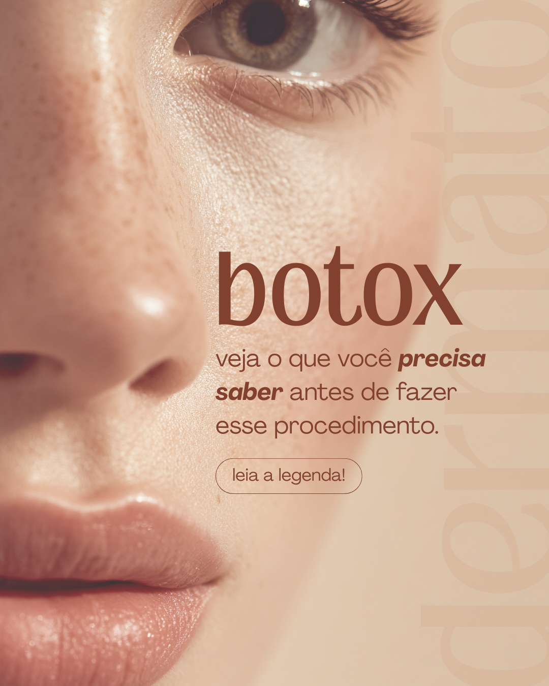 Botox